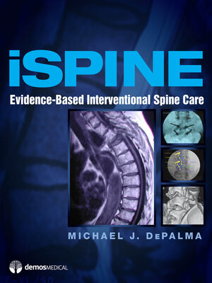 cover image of iSpine